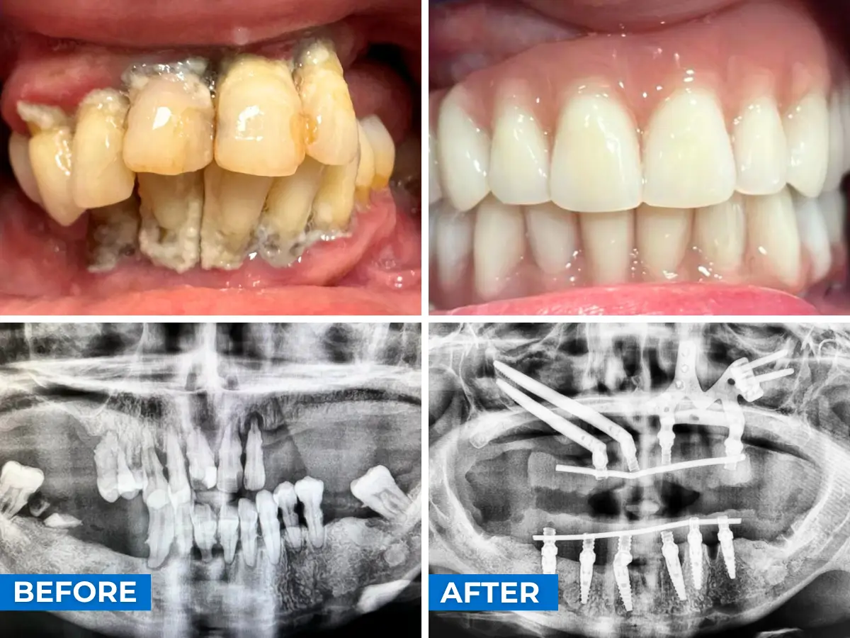 Nowoczesna klinika stomatologiczna Elite Smile Poznań – komfortowe wnętrze i profesjonalny zespół