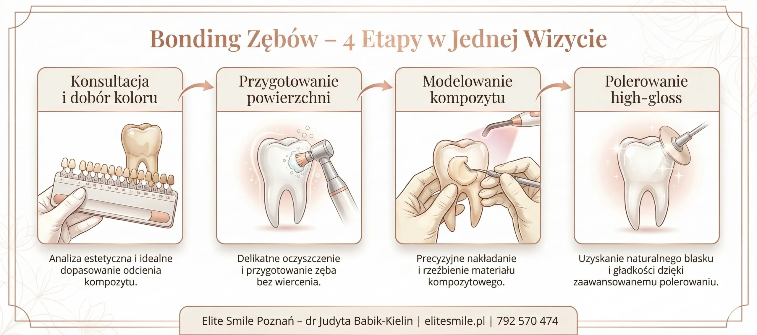 Etapy zabiegu bondingu zębów – konsultacja, modelowanie kompozytu, utwardzanie UV, polerowanie – Elite Smile Poznań