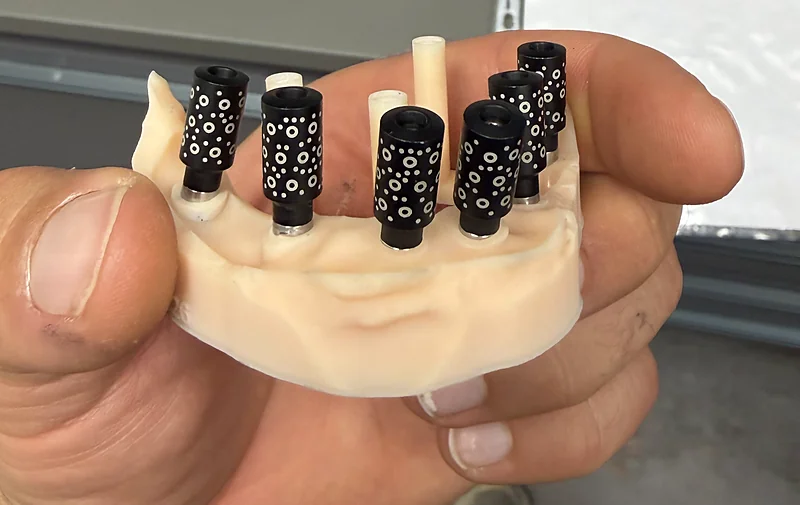 Markery fotogrametryczne Tupel 3D wkręcone na łączniki multi-unit — rejestracja pozycji implantów w Elite Smile Poznań