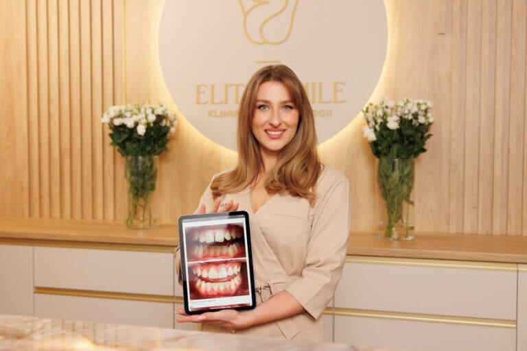 Elite Smile recepcja
